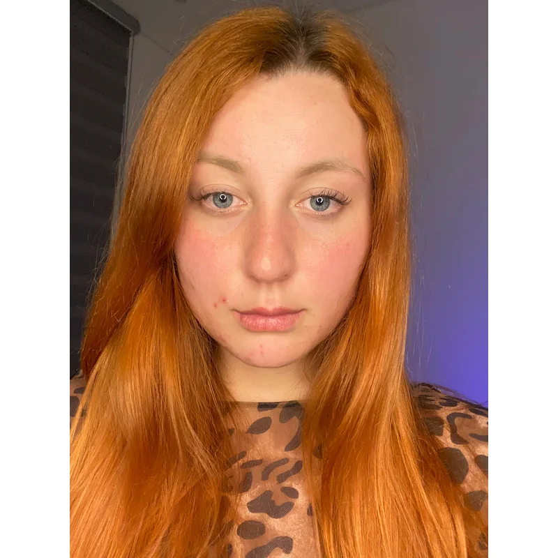 flame_fox